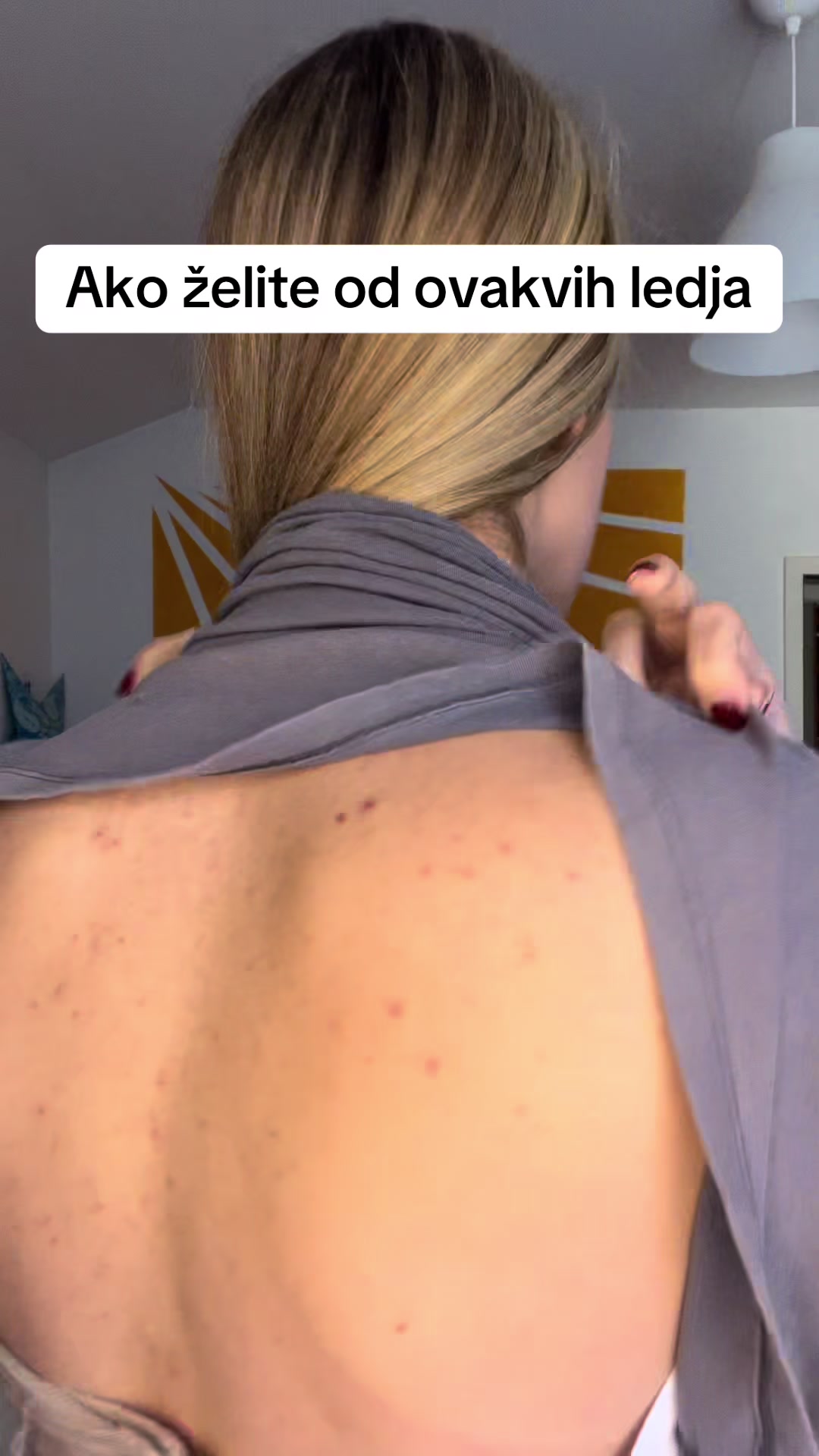 @obrisii.flekice