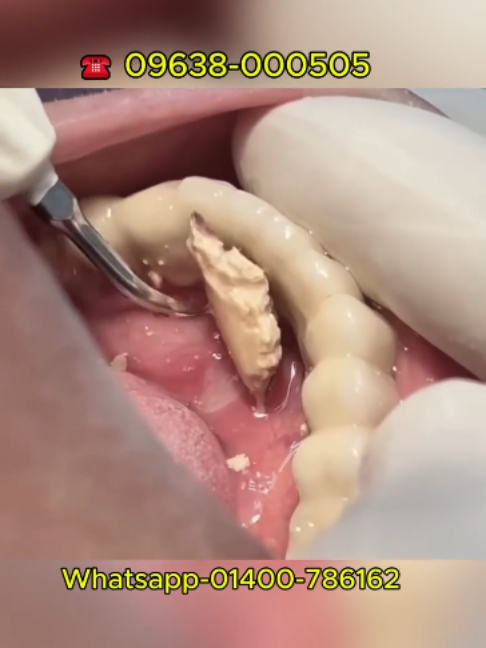 @Tech Dental