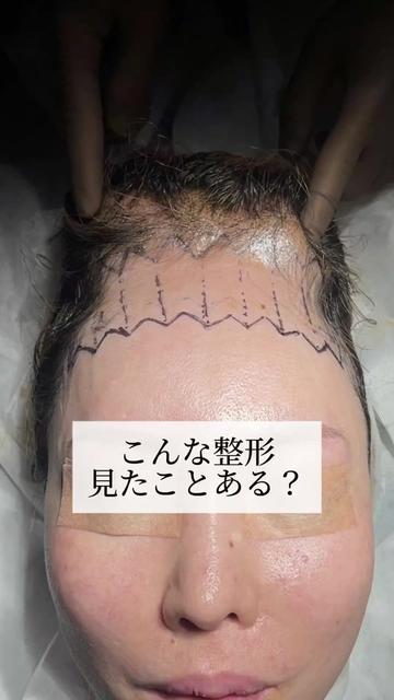 @鼻整形R Beauty CLINIC 副院長👨&zwj;⚕️吉田慧