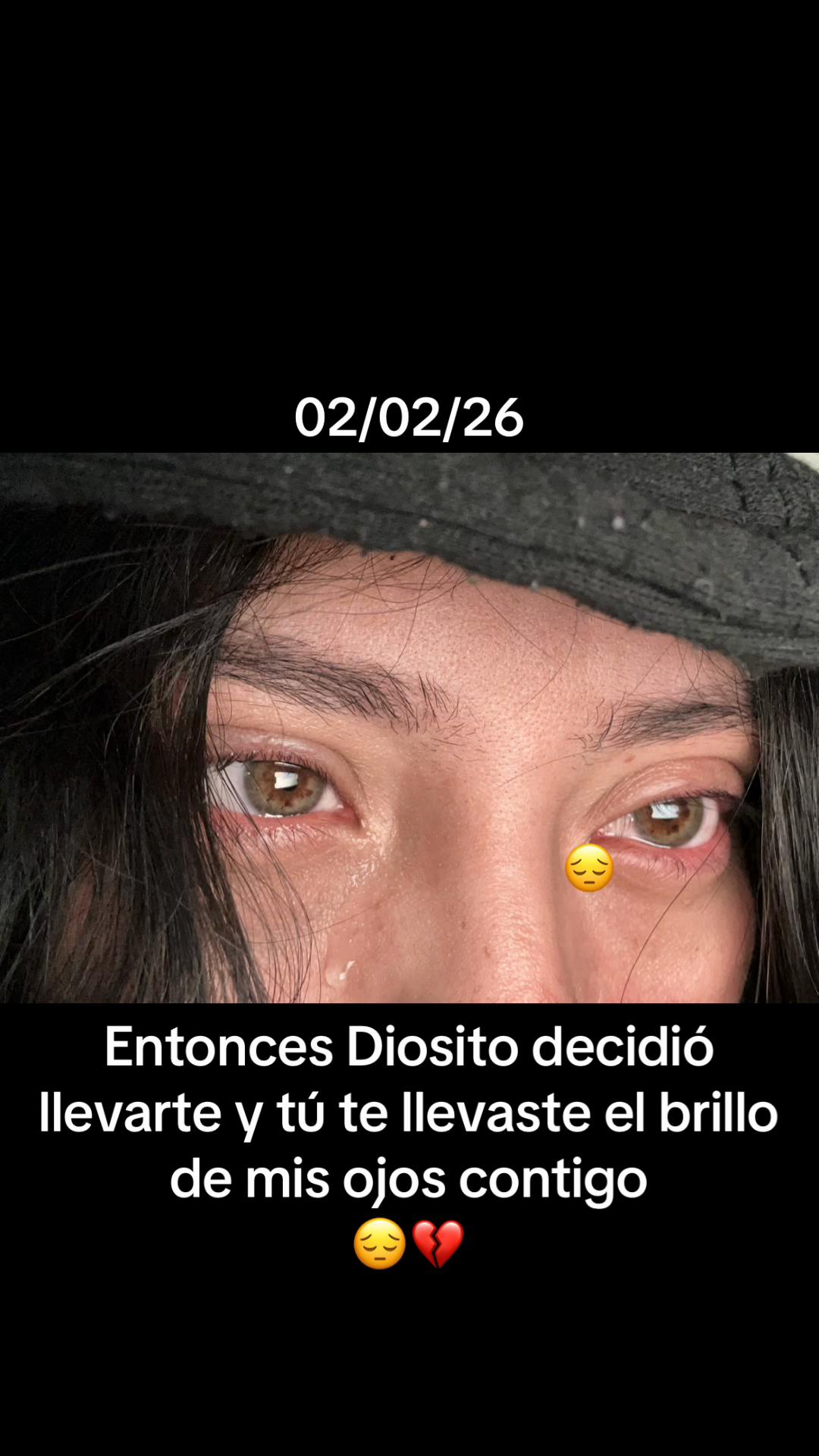 @๐ข๐ojitos -verdes๐๐ข