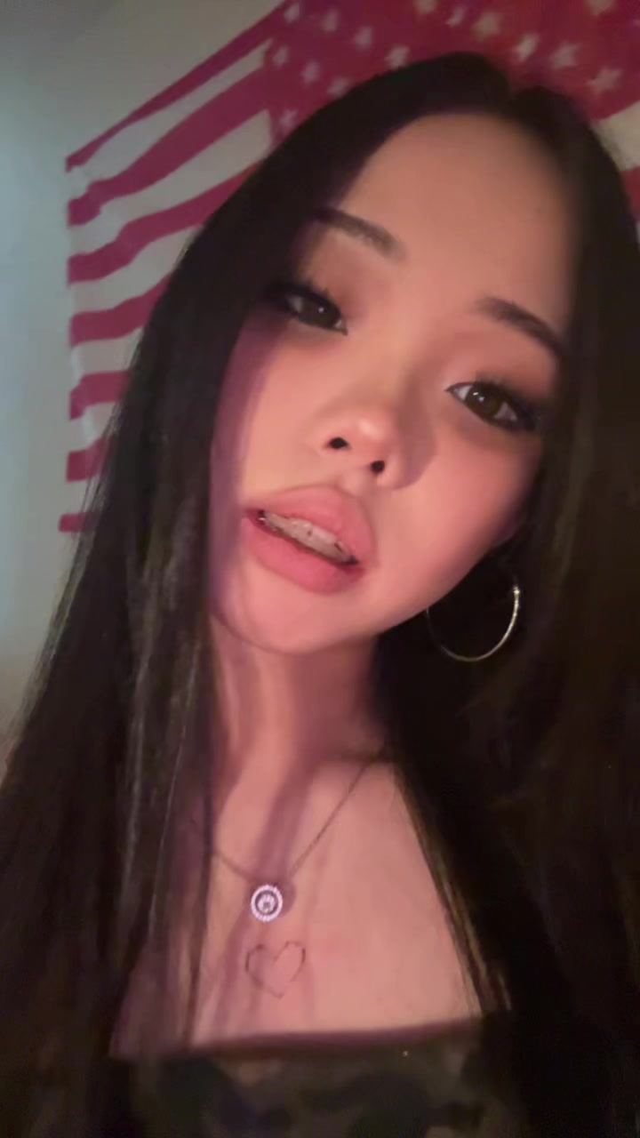 @kiss