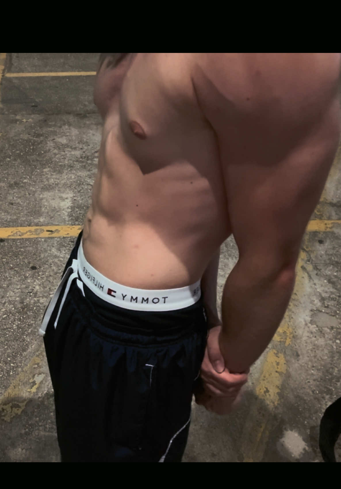 @AE