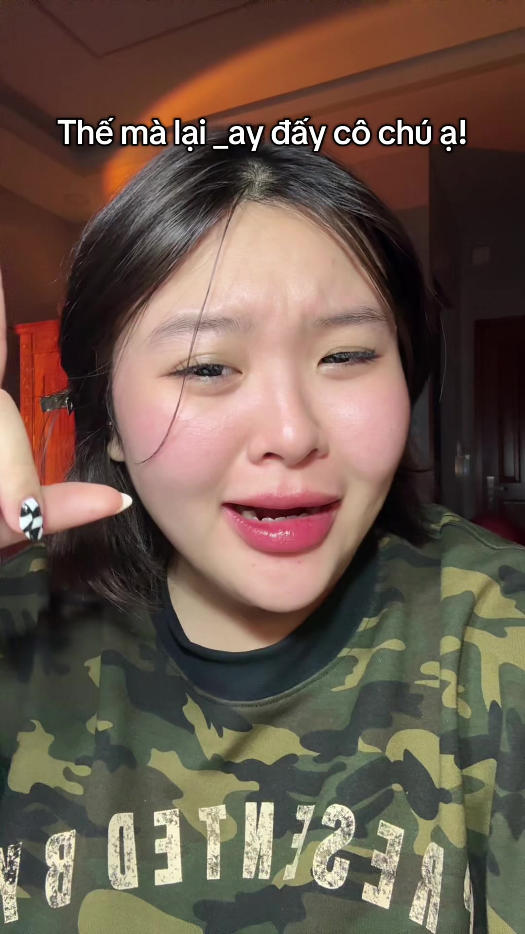 @Đu Đu sún răng