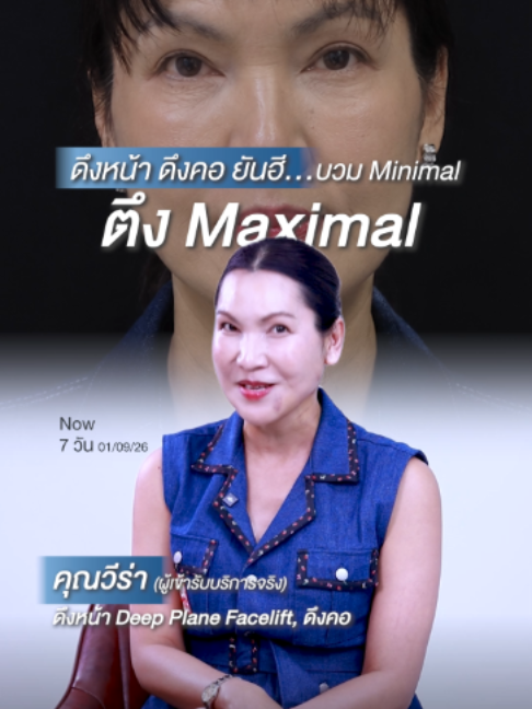 @โรงพยาบาลยันฮี