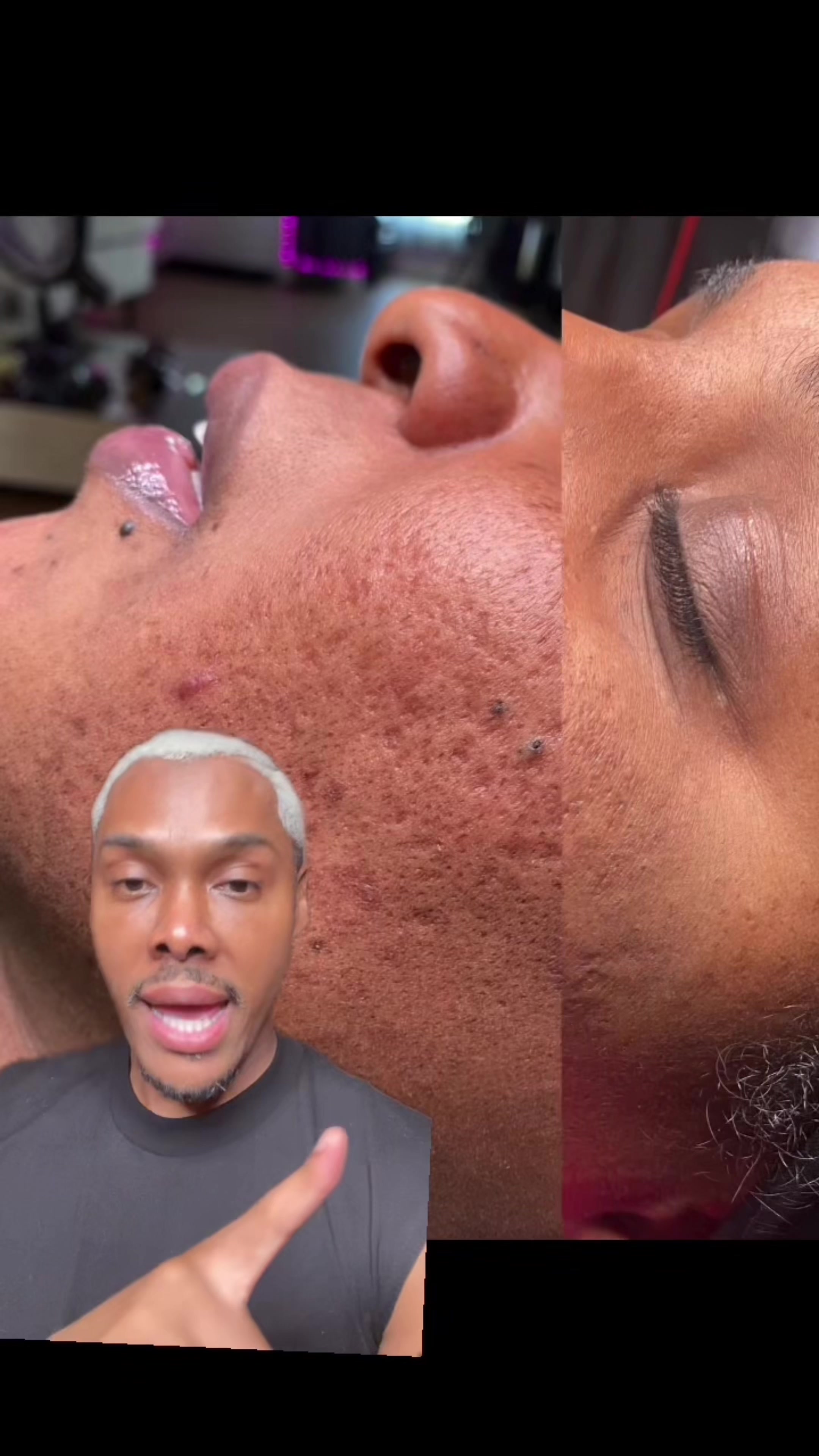 @Ronnie