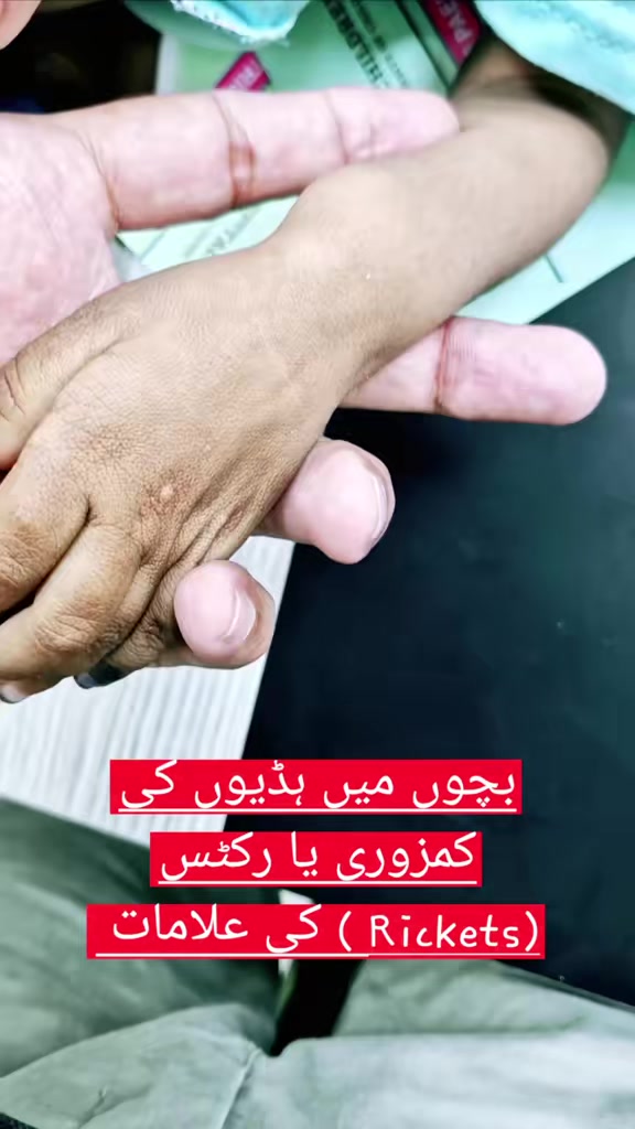 @Dr Arshad Child Neurologist