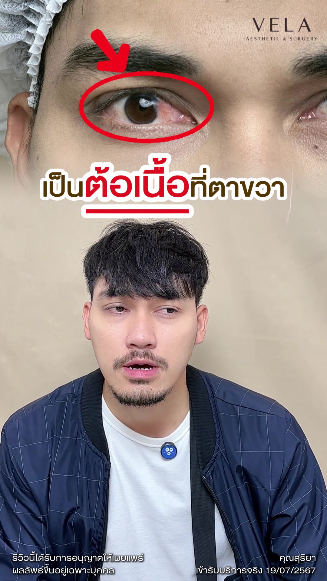 @atier.eyesurgery