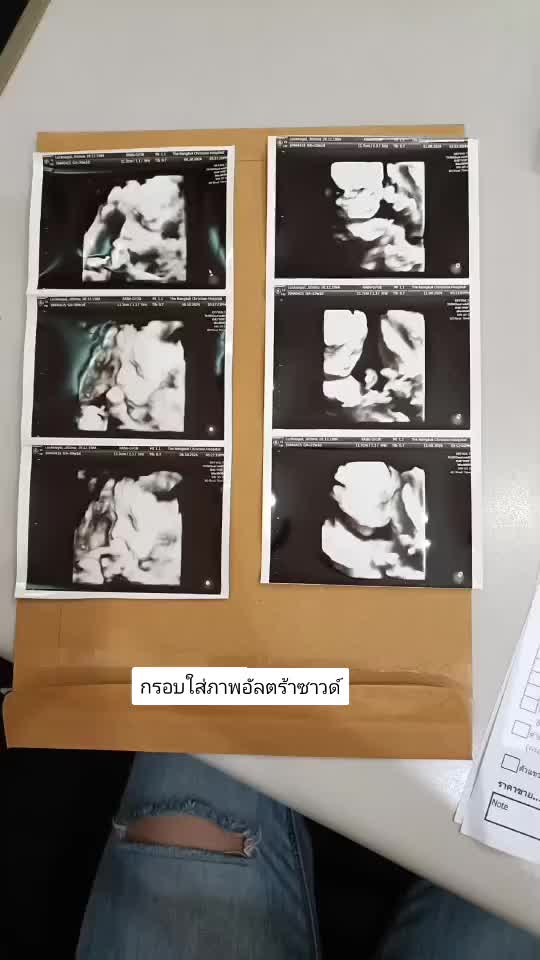 @BangkokFrame