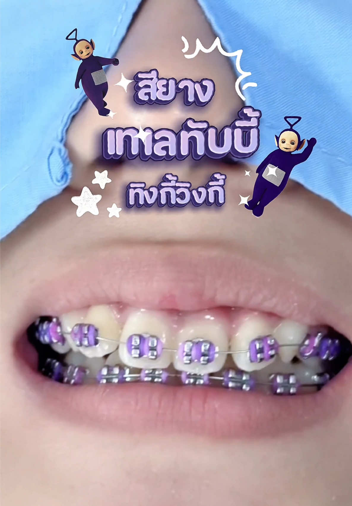 @ideasmilebu