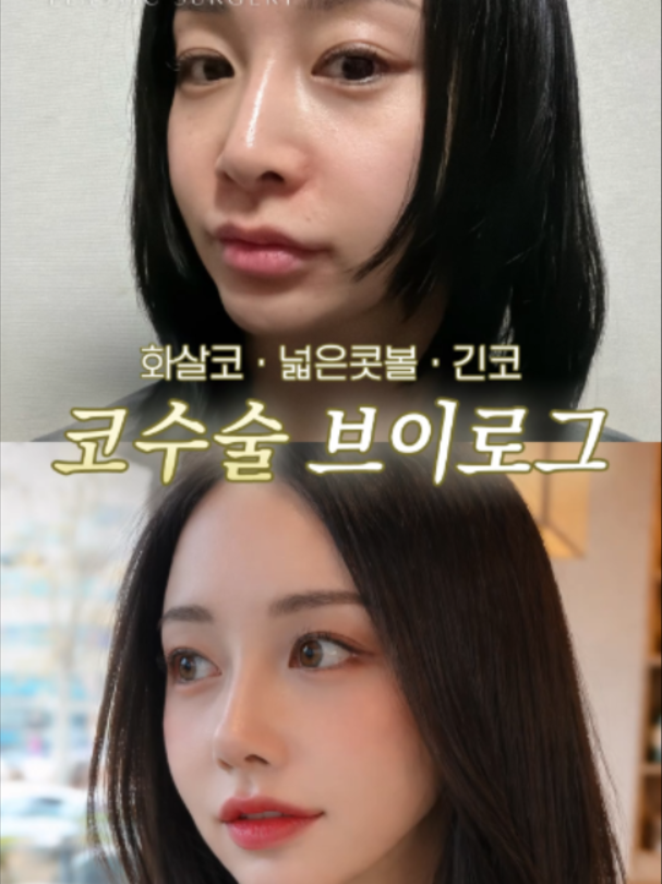 @리셋성형외과