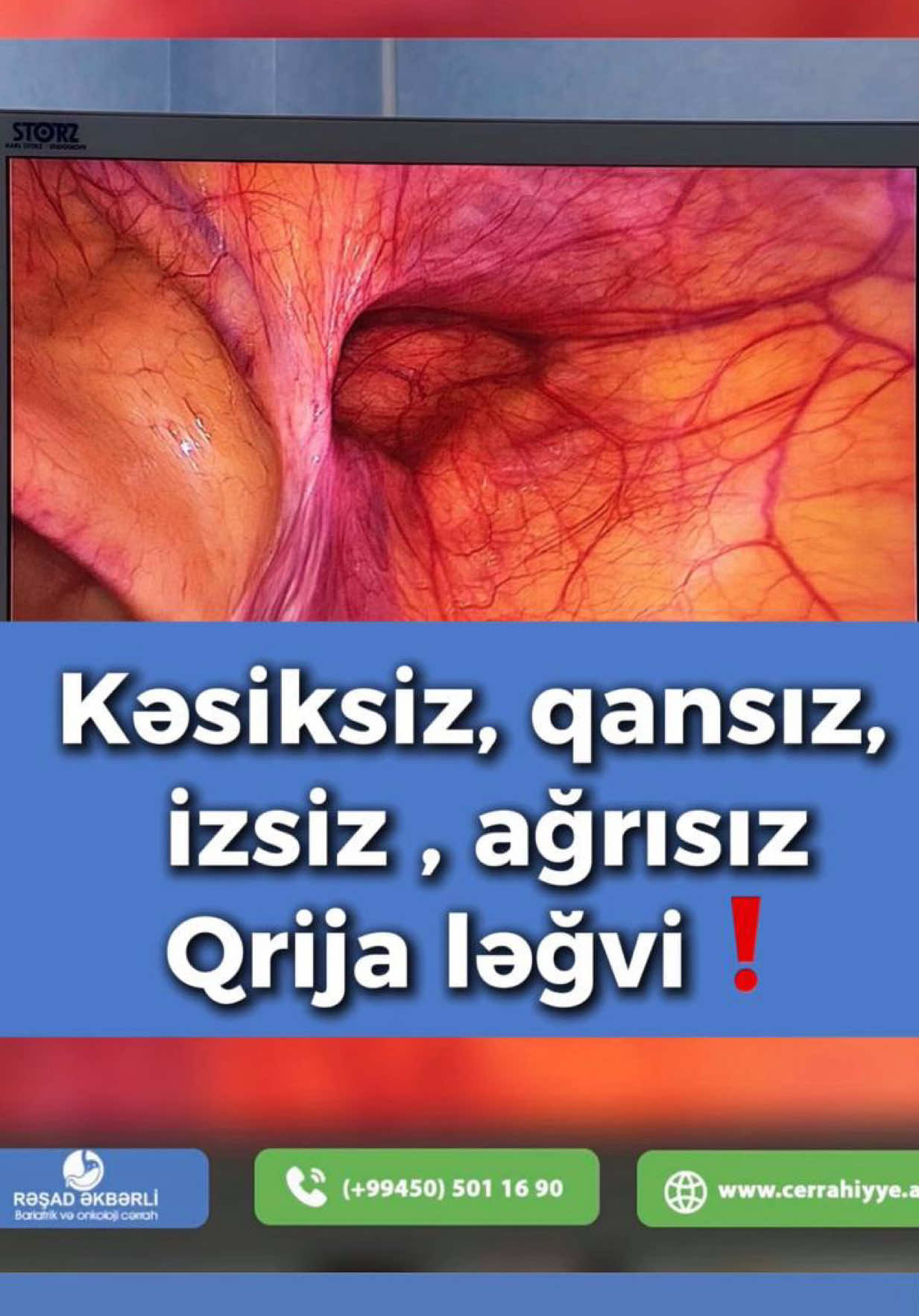 @Ümumi Cərrah Rəşad Əkbərli
