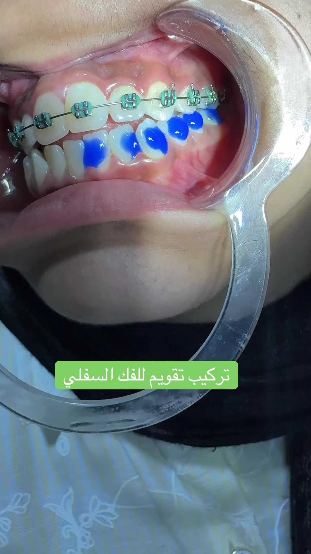 @Dr Mohamed Khattab