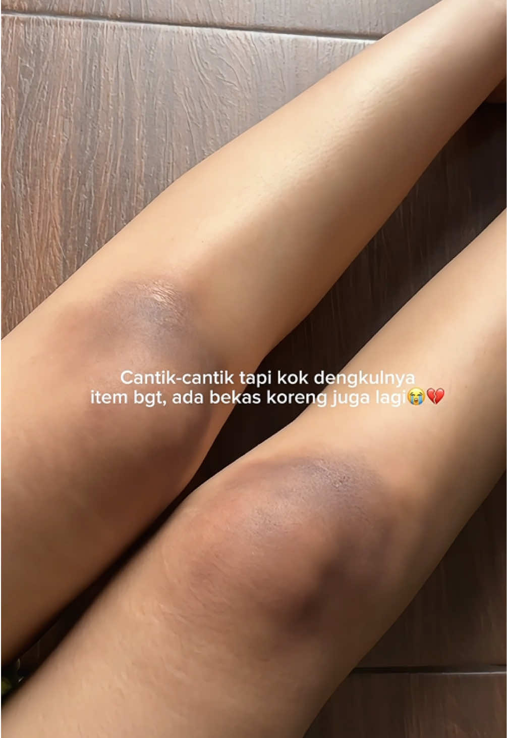 @Hi, ini vani
