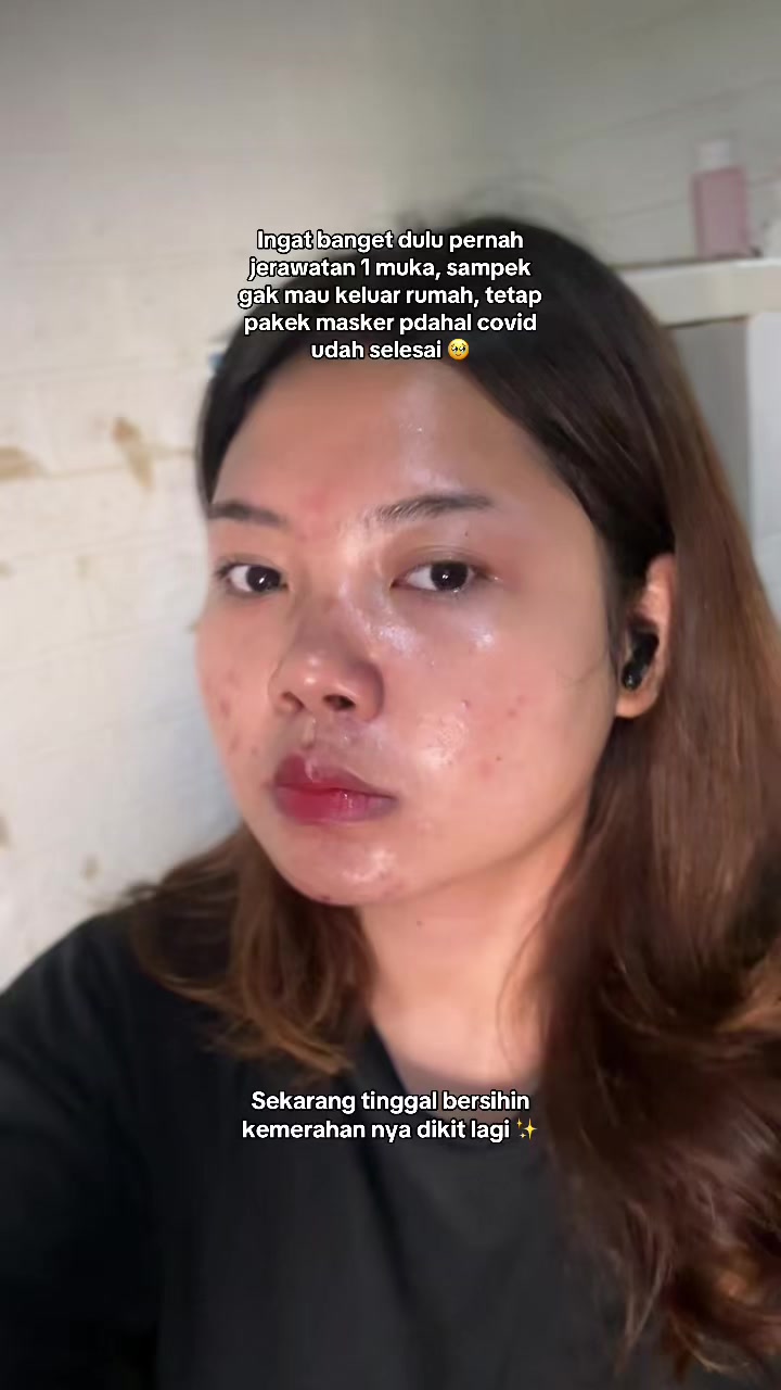 @ichi | glow up journey