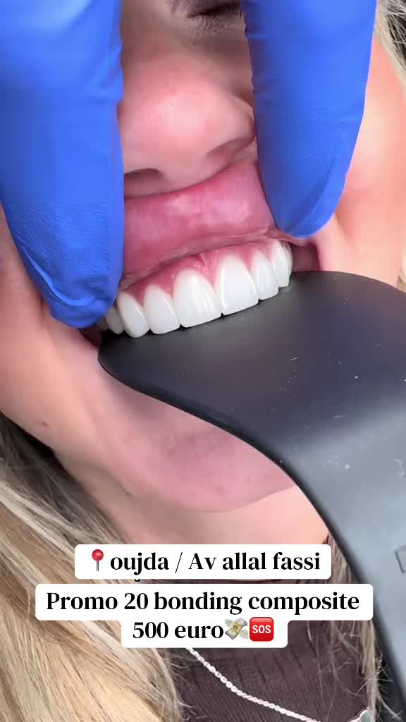 @brightsmileee1