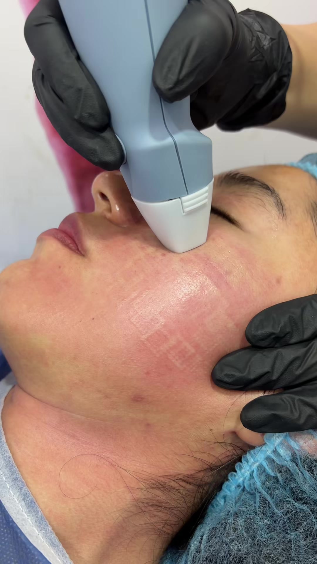 @Dermatóloga Cindy Burbano