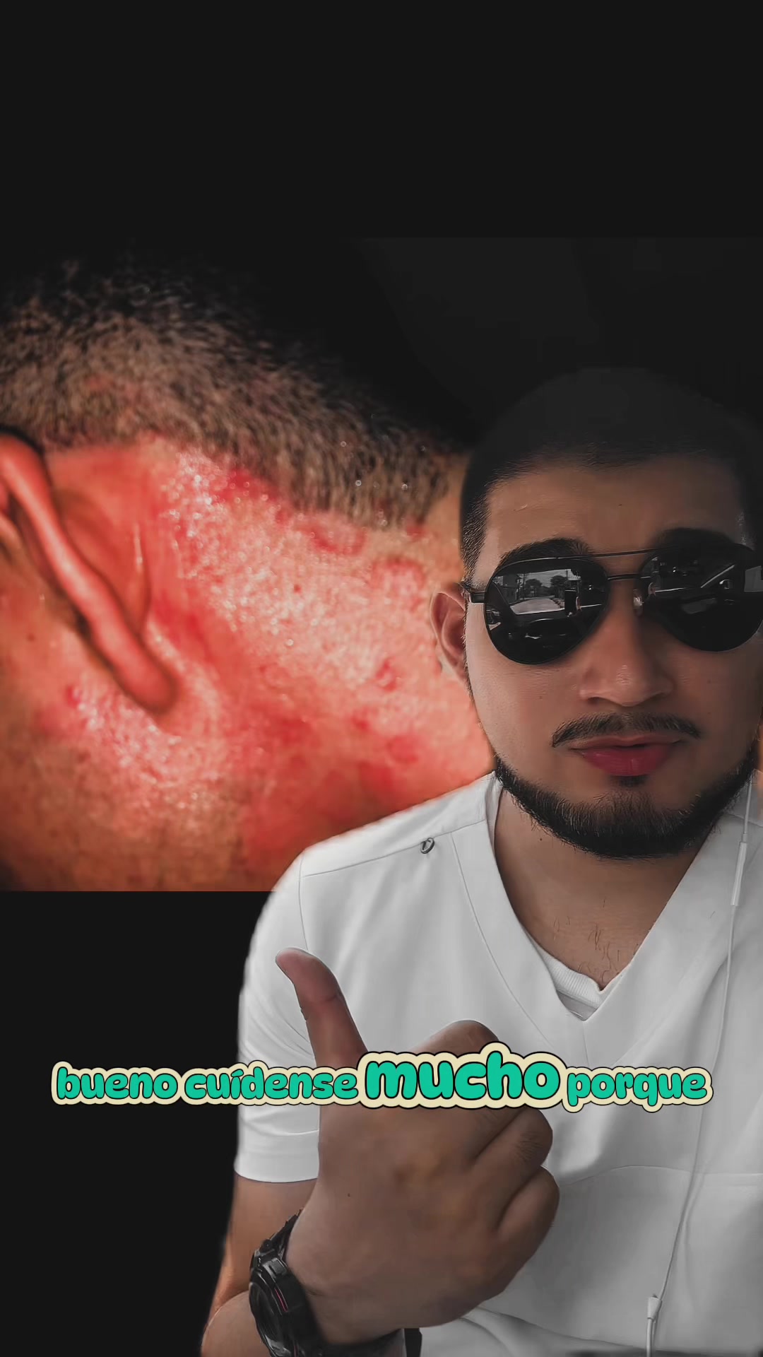 @Rabanito