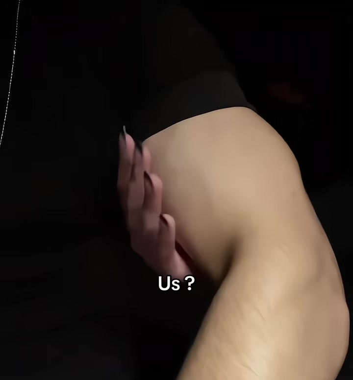 @َ