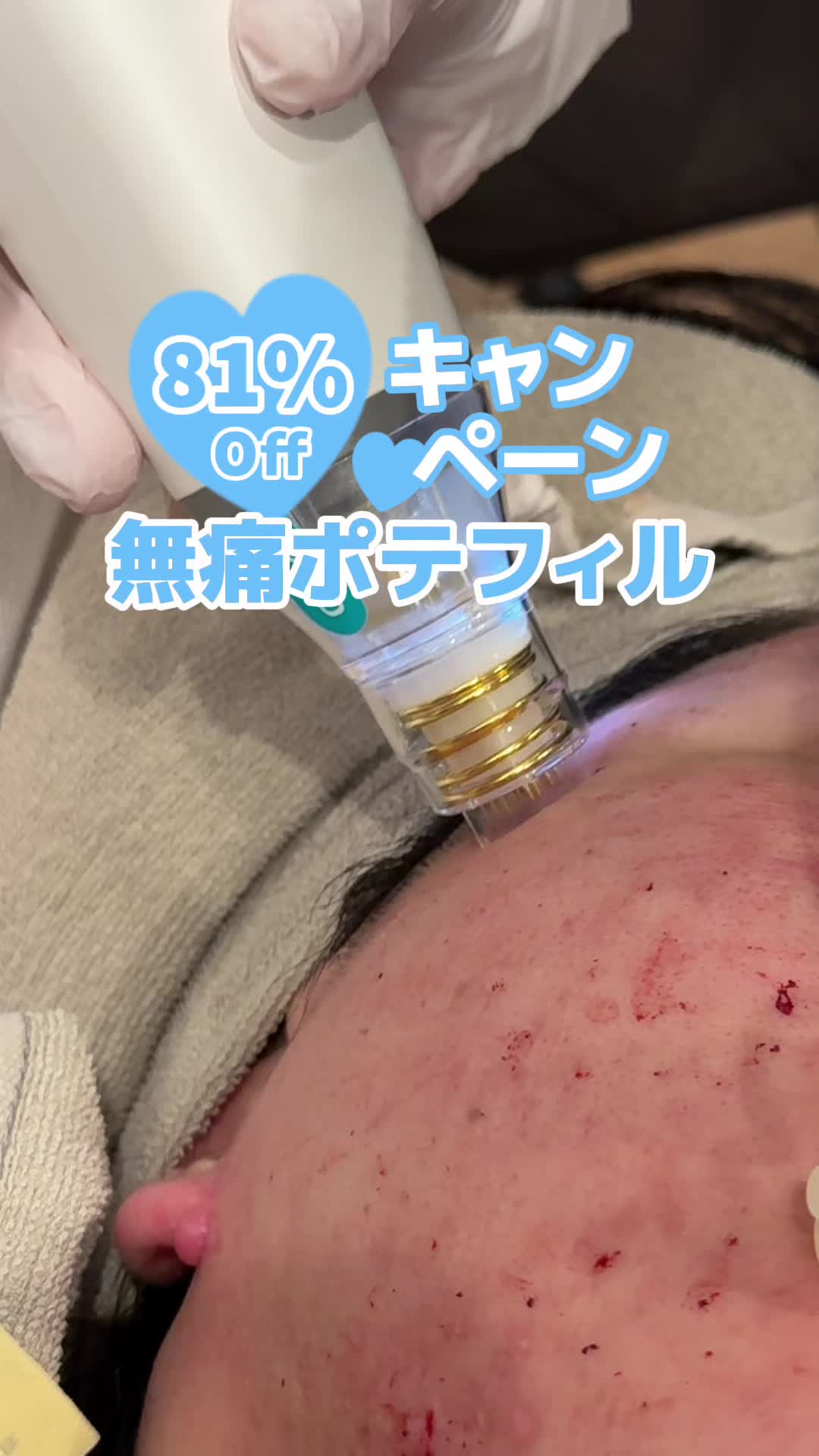@beyound.the.light.clinic