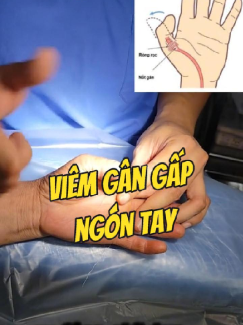 @Chuyên gia xương khớp