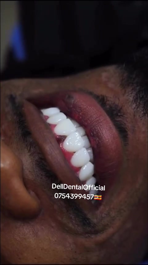 @DellDentalOfficial
