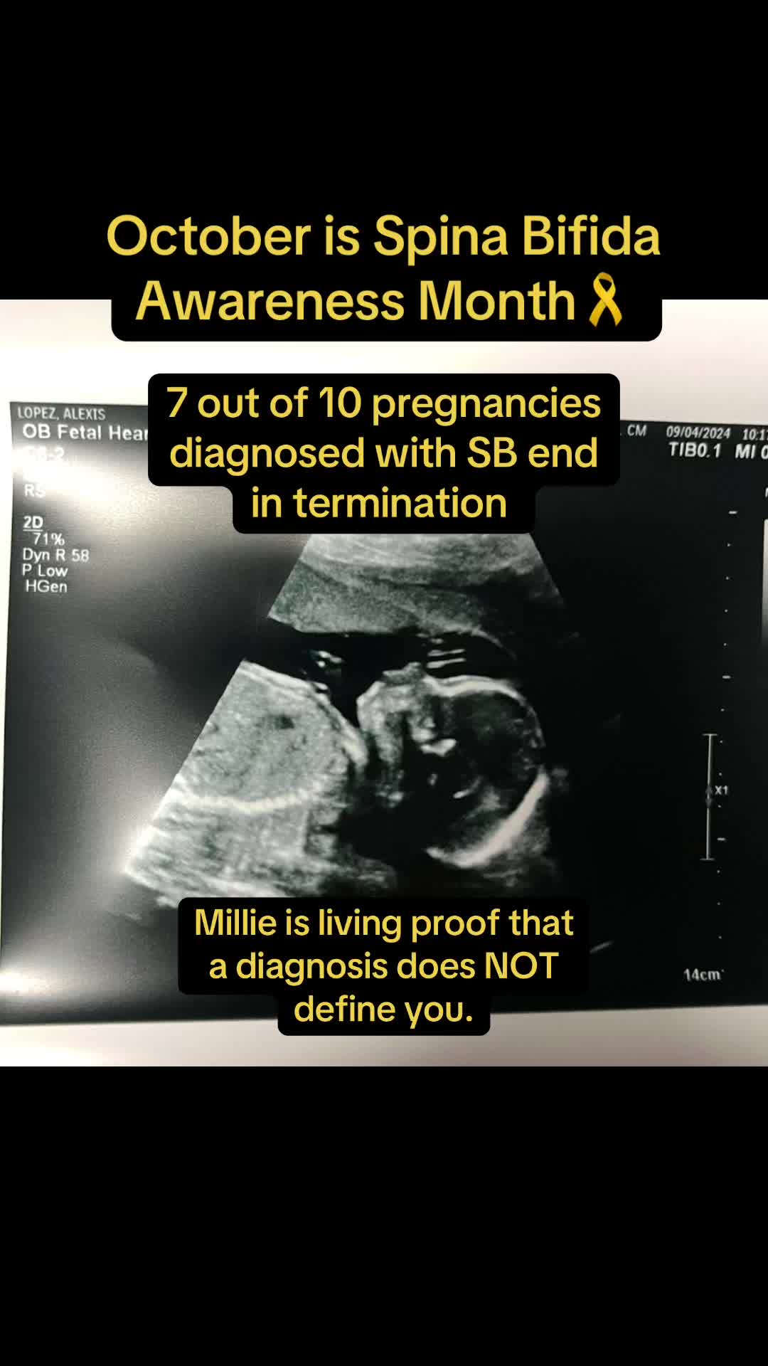 @Lexy | SB Momma🎗️