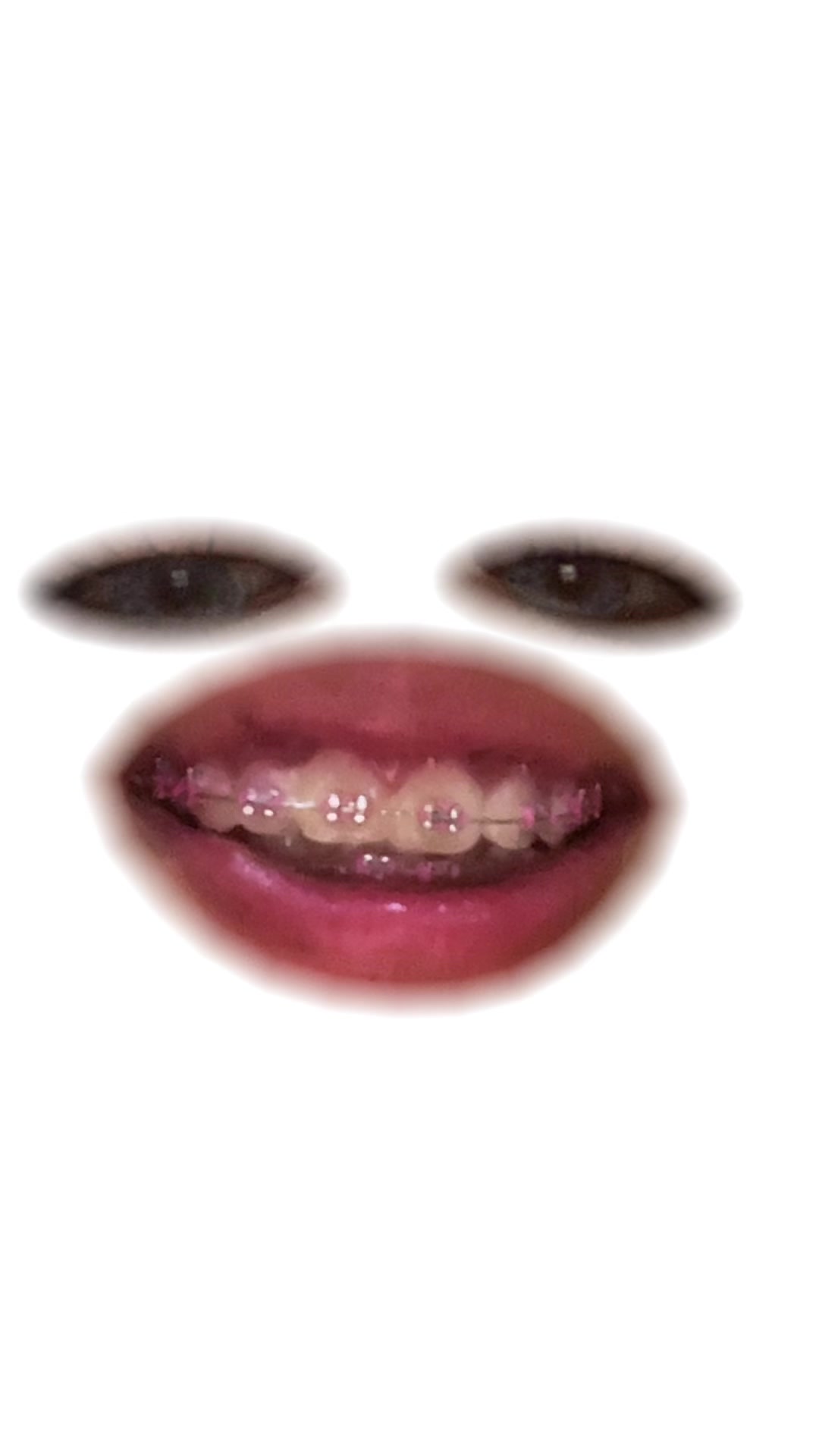 @vianaNG
