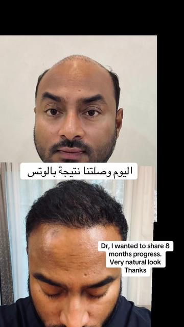 @Dr. Ahmed Alkhateeb