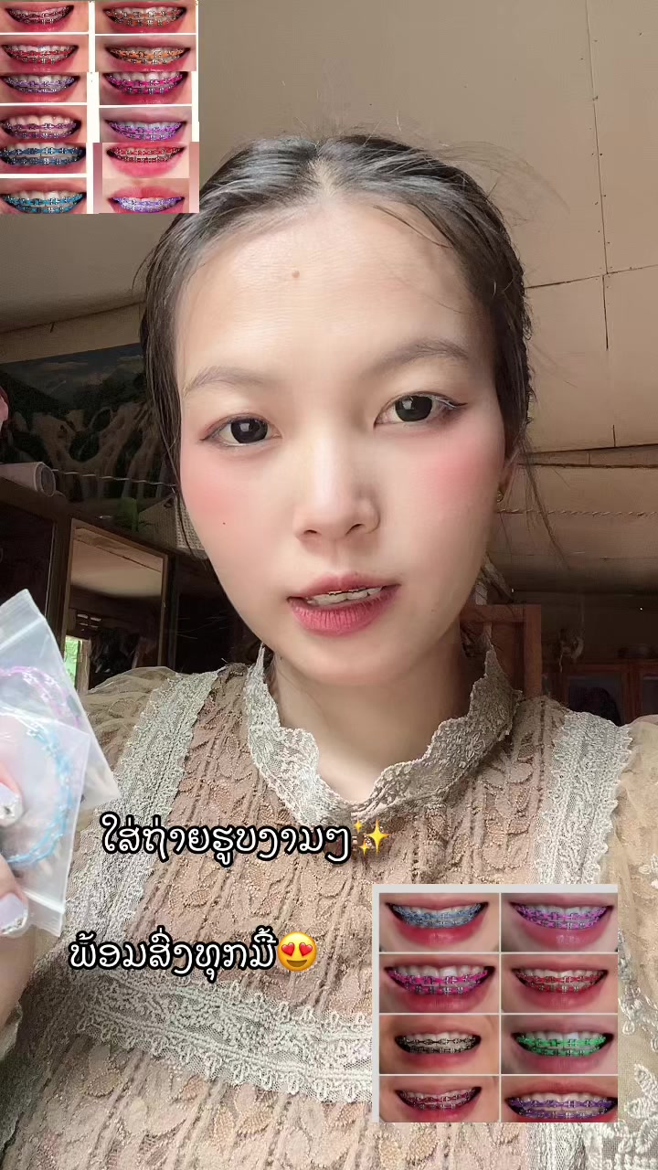 @ເພຈ.ແມ່ຄ້າຂາຍເຫລັກດັດຟັນ✨🛍️