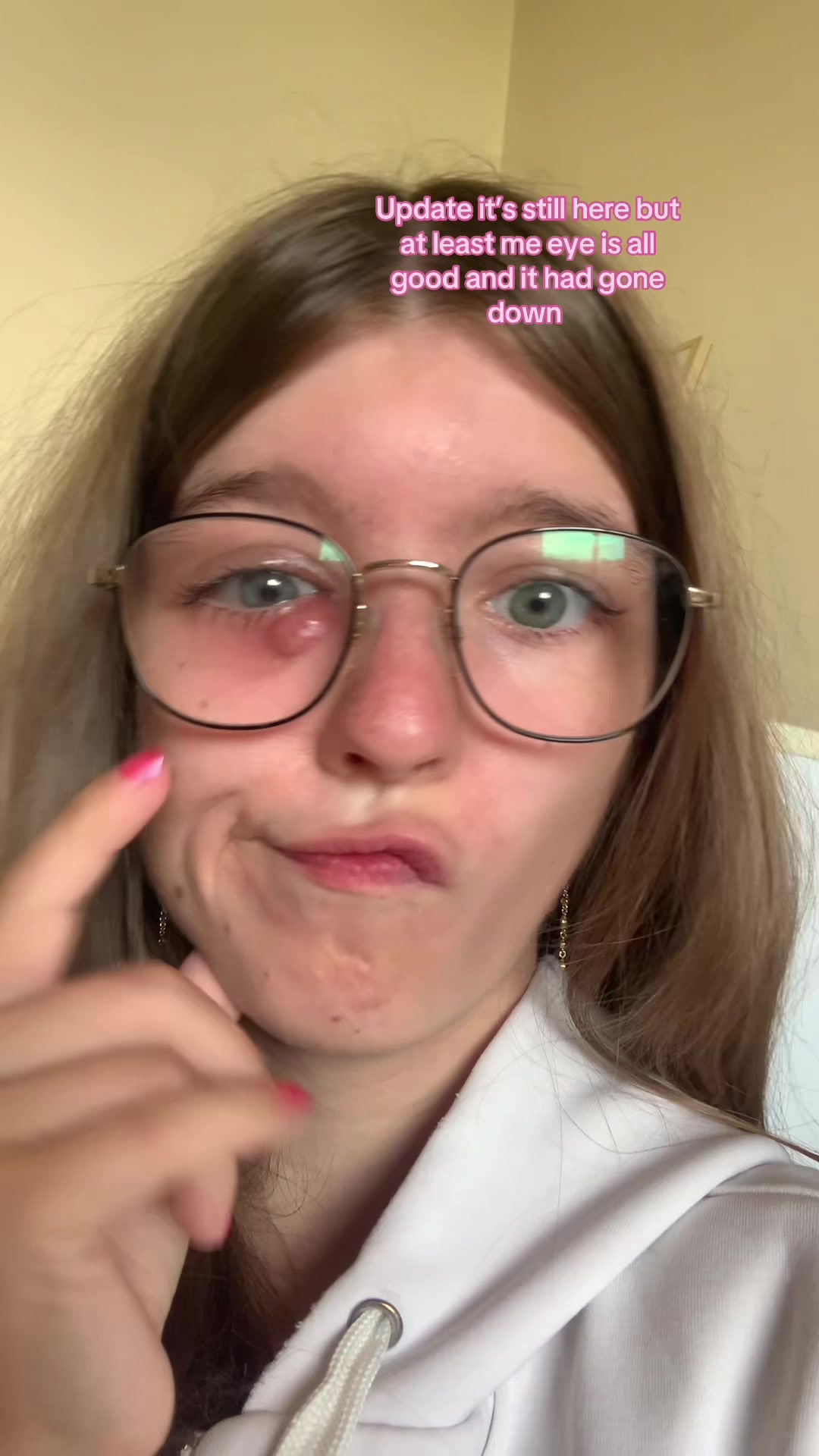 @Alana