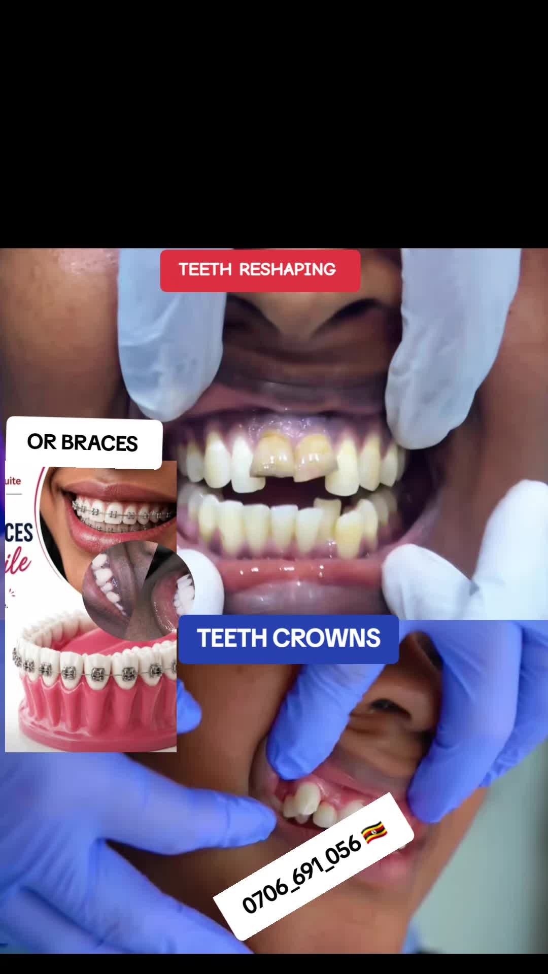 @Dental studio.🦷.Kampala