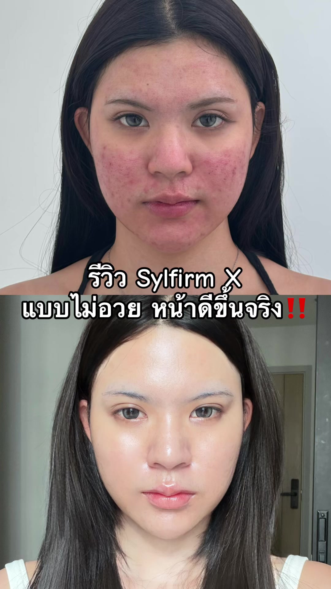 @APEXYOUNGCLINIC