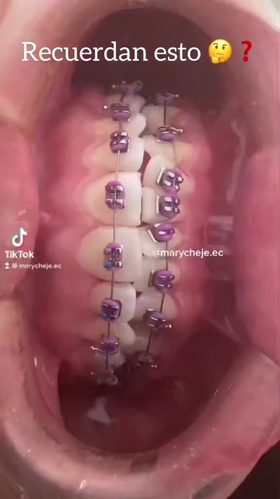 @Od. Marilyn Chejade L. 😷🦷