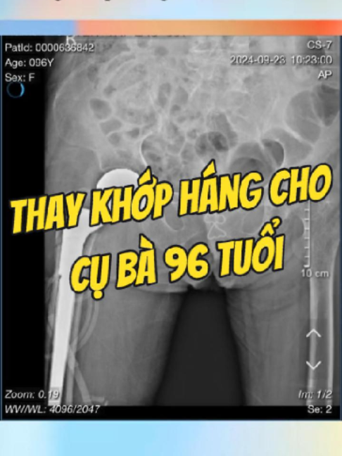 @Chuyên gia xương khớp