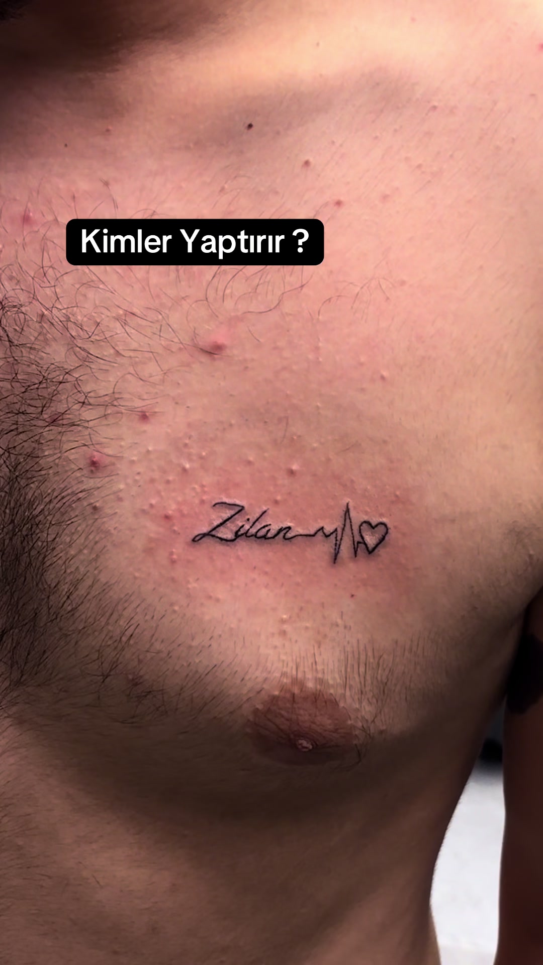 @avcilar_dovmecisi