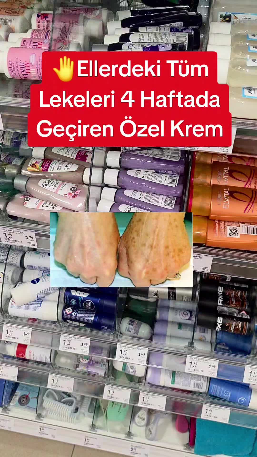@Gurbetana27