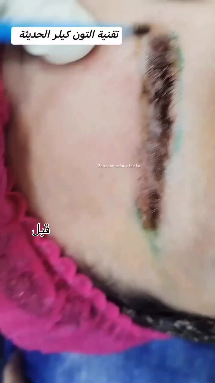@الدكتورة زهراء حازم