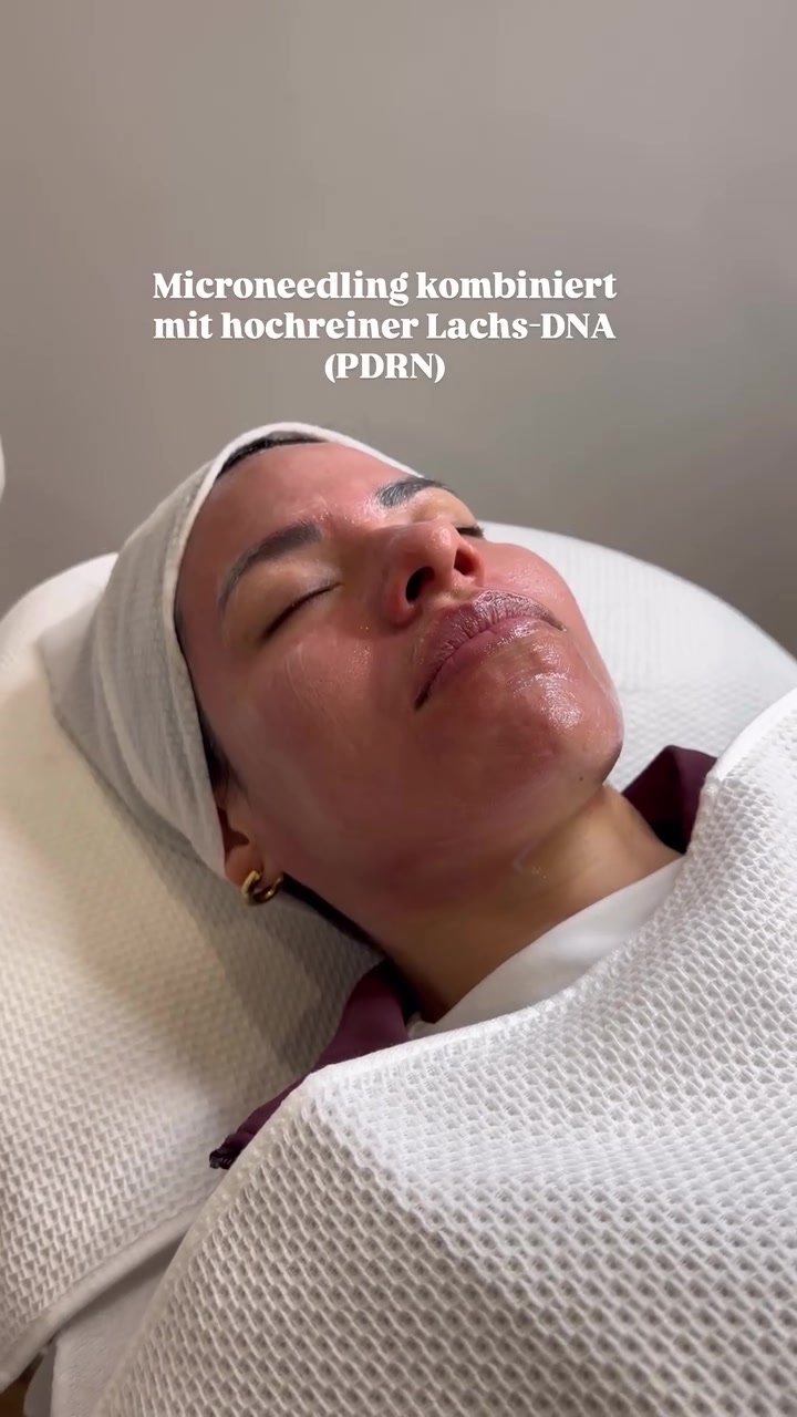 @soul_laeseraesthetic