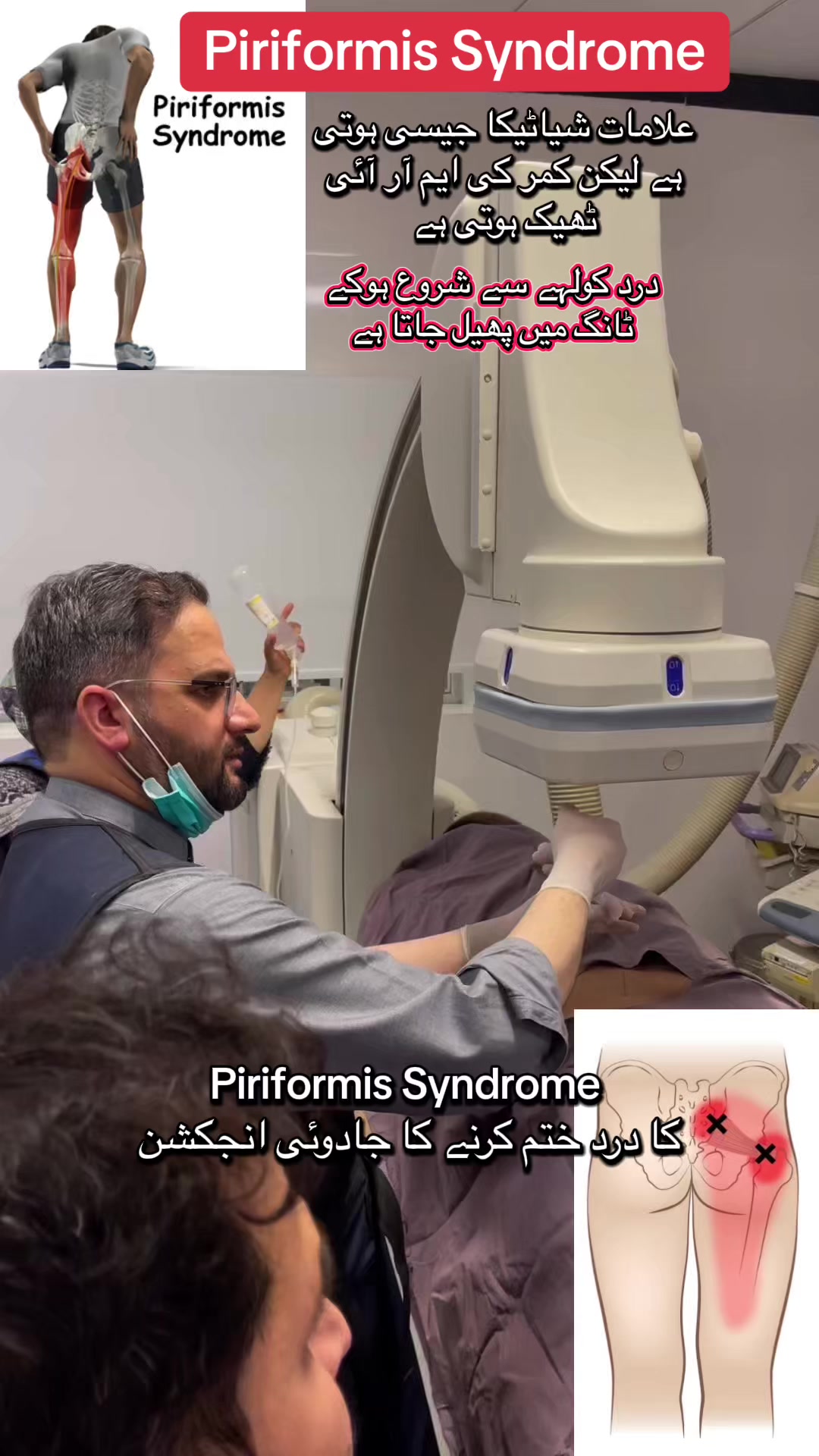 @@Dr.Ibrar Spine &Ortho Surgeon