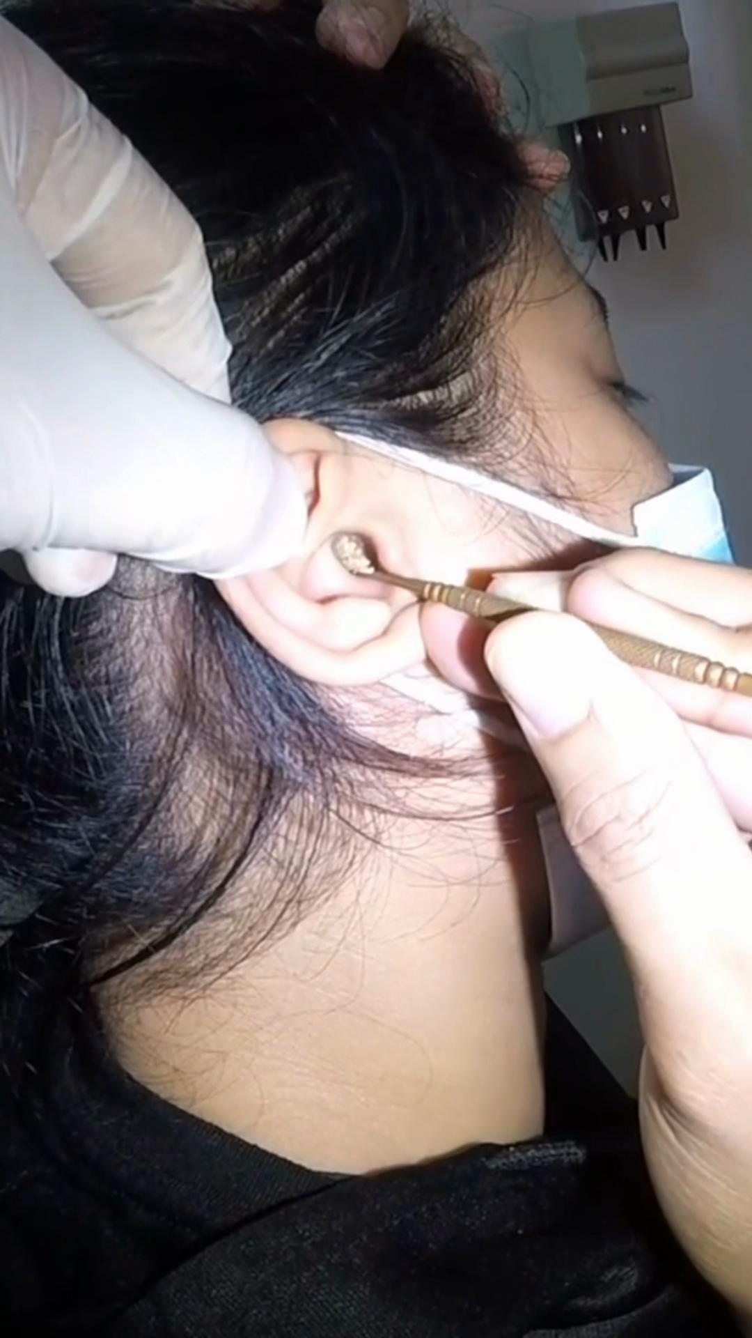 @TheEarwaxSpecialist