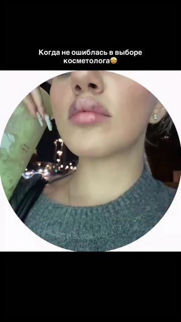 @КОСМЕТОЛОГ &bull; УВЕЛИЧЕНИЕ ГУБ