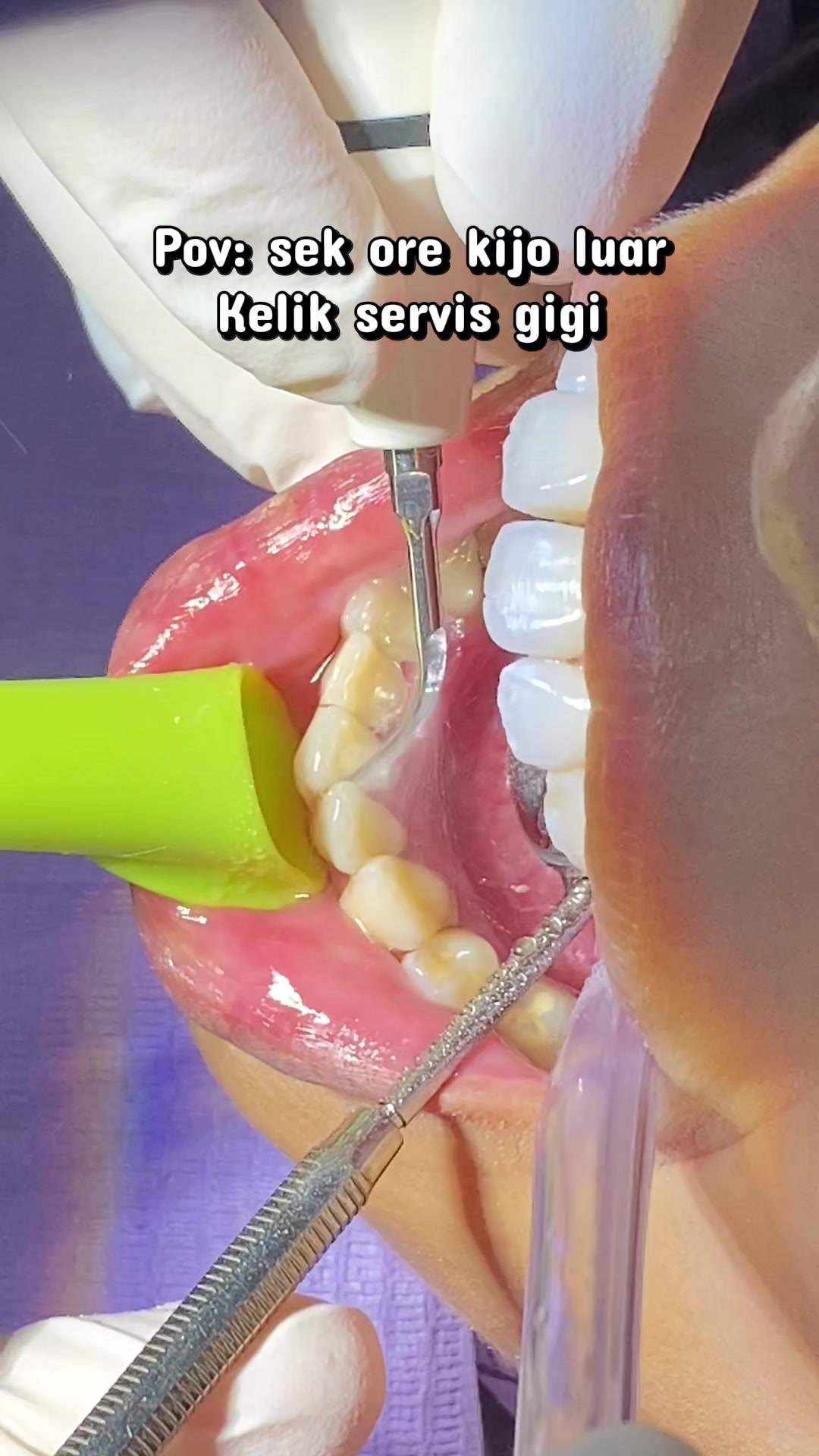 @klinikpergigianprimera