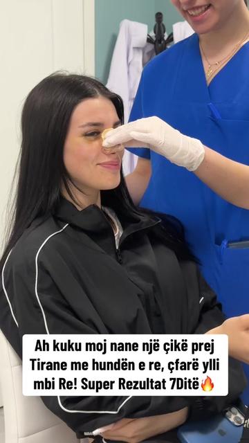 @rinoplasticatirana