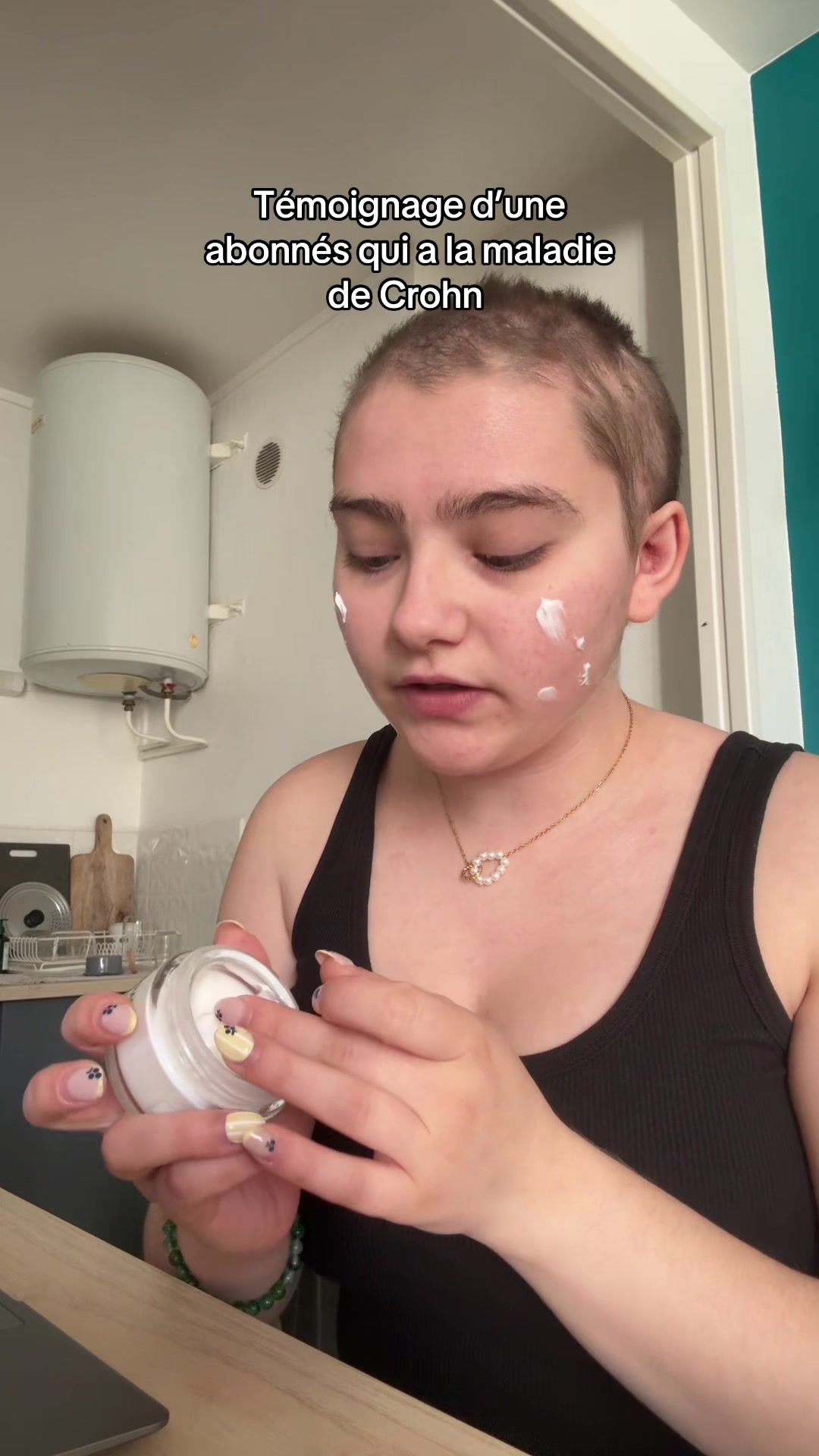 @Crohngirls