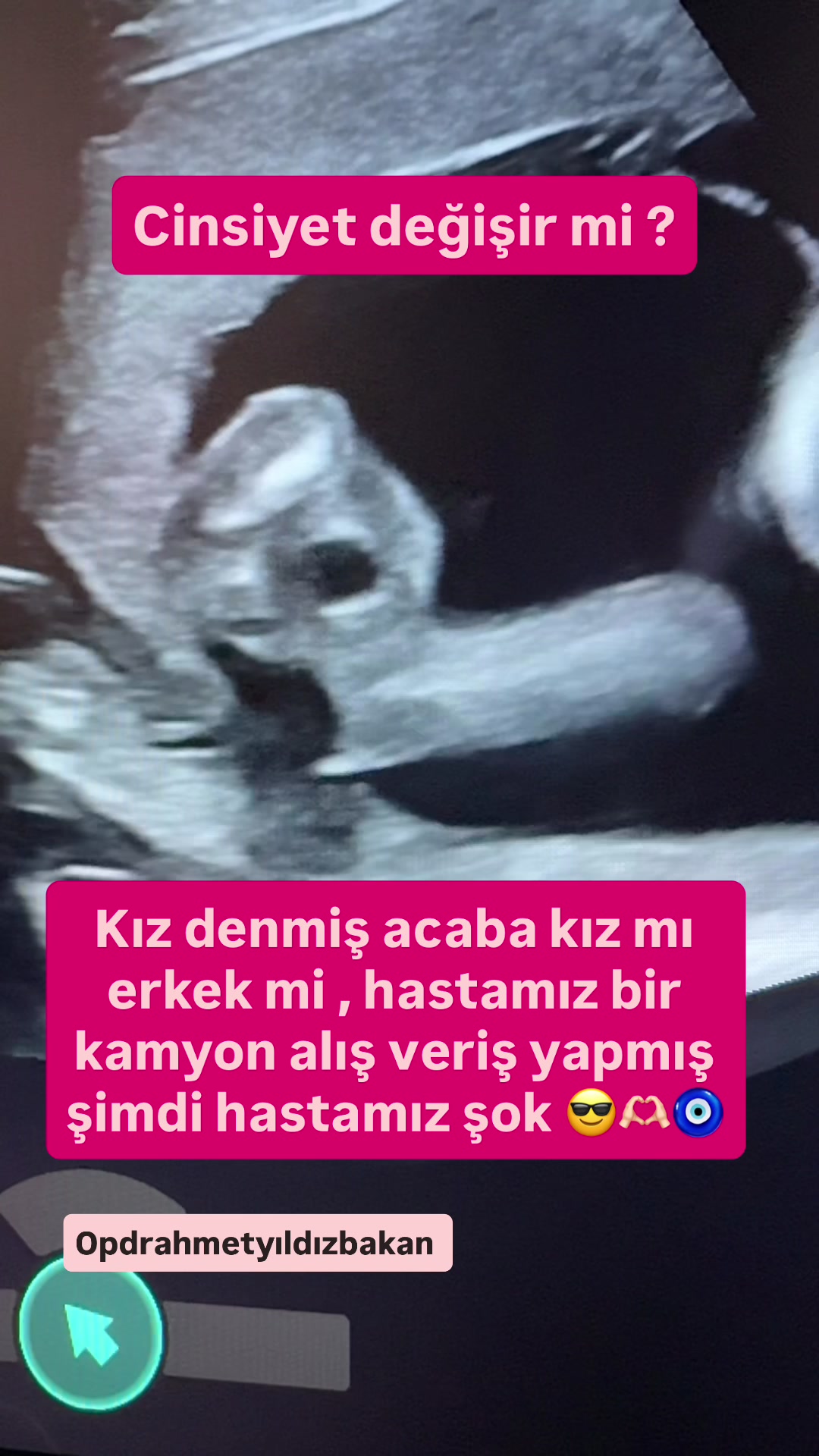 @opdrahmetyildizbakan