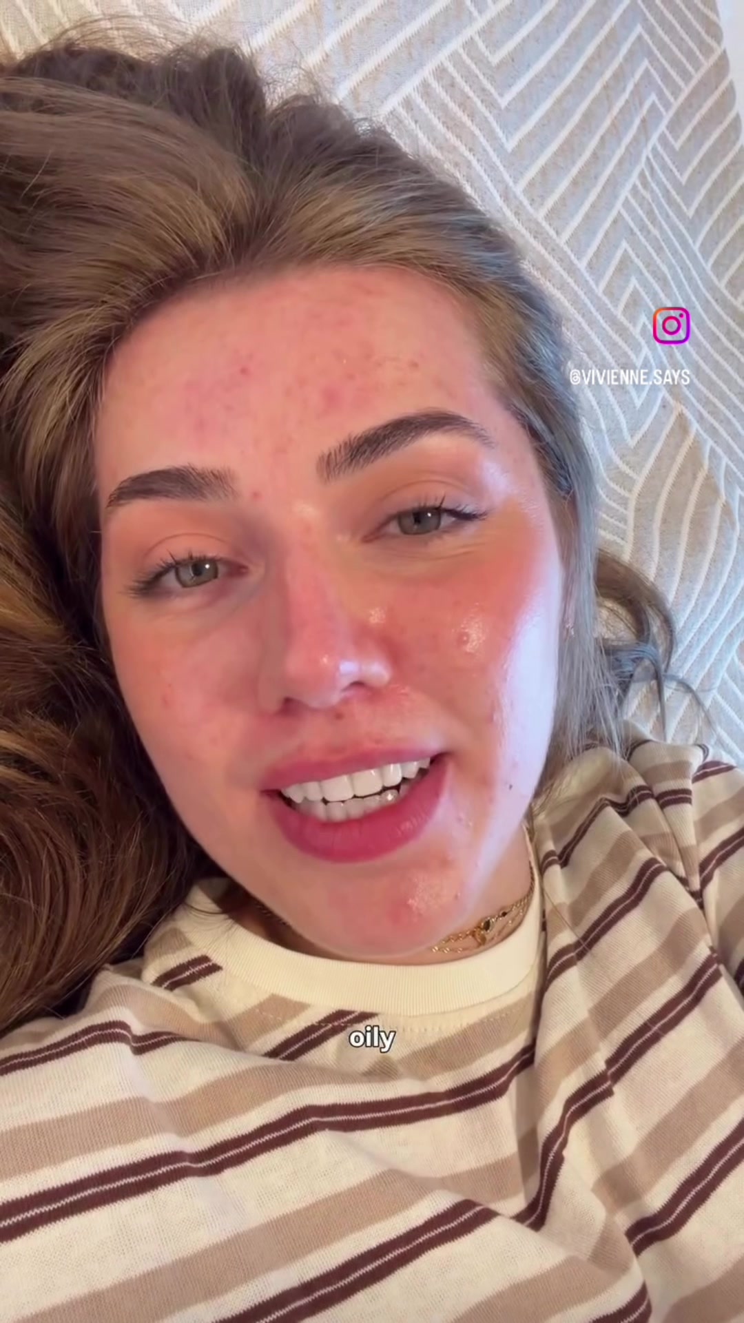 @Pure Skin OC