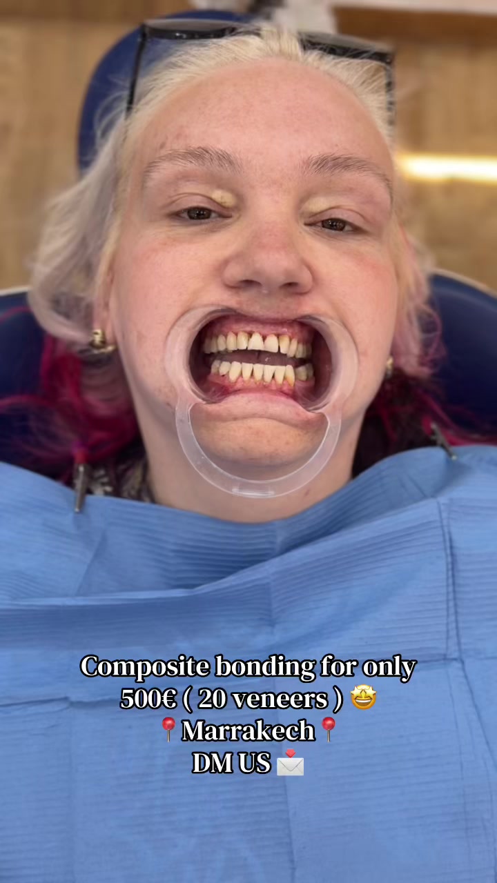 @Smilesecret