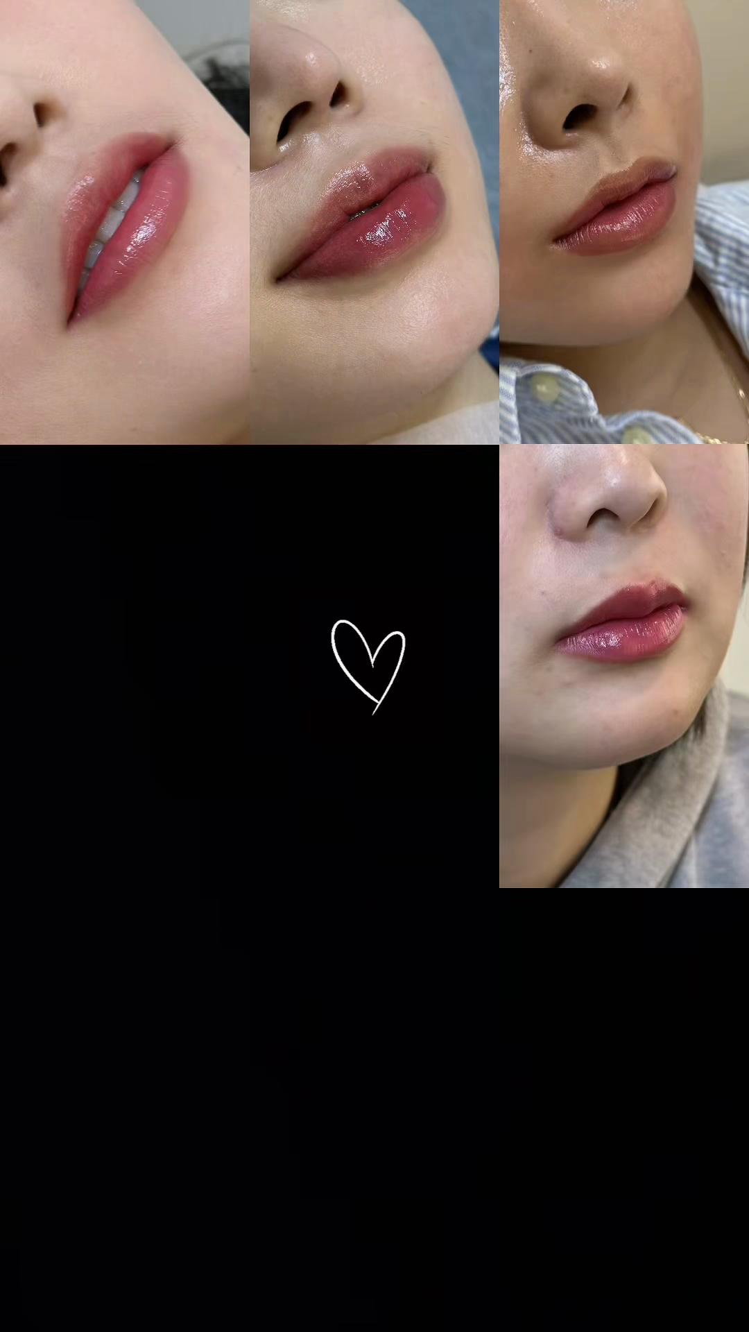 @써지브로우 surgebrow