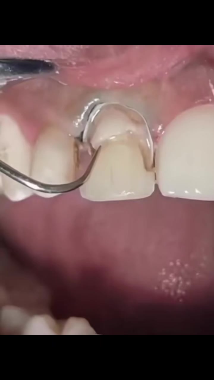 @Dr_sheraz_official 🦷