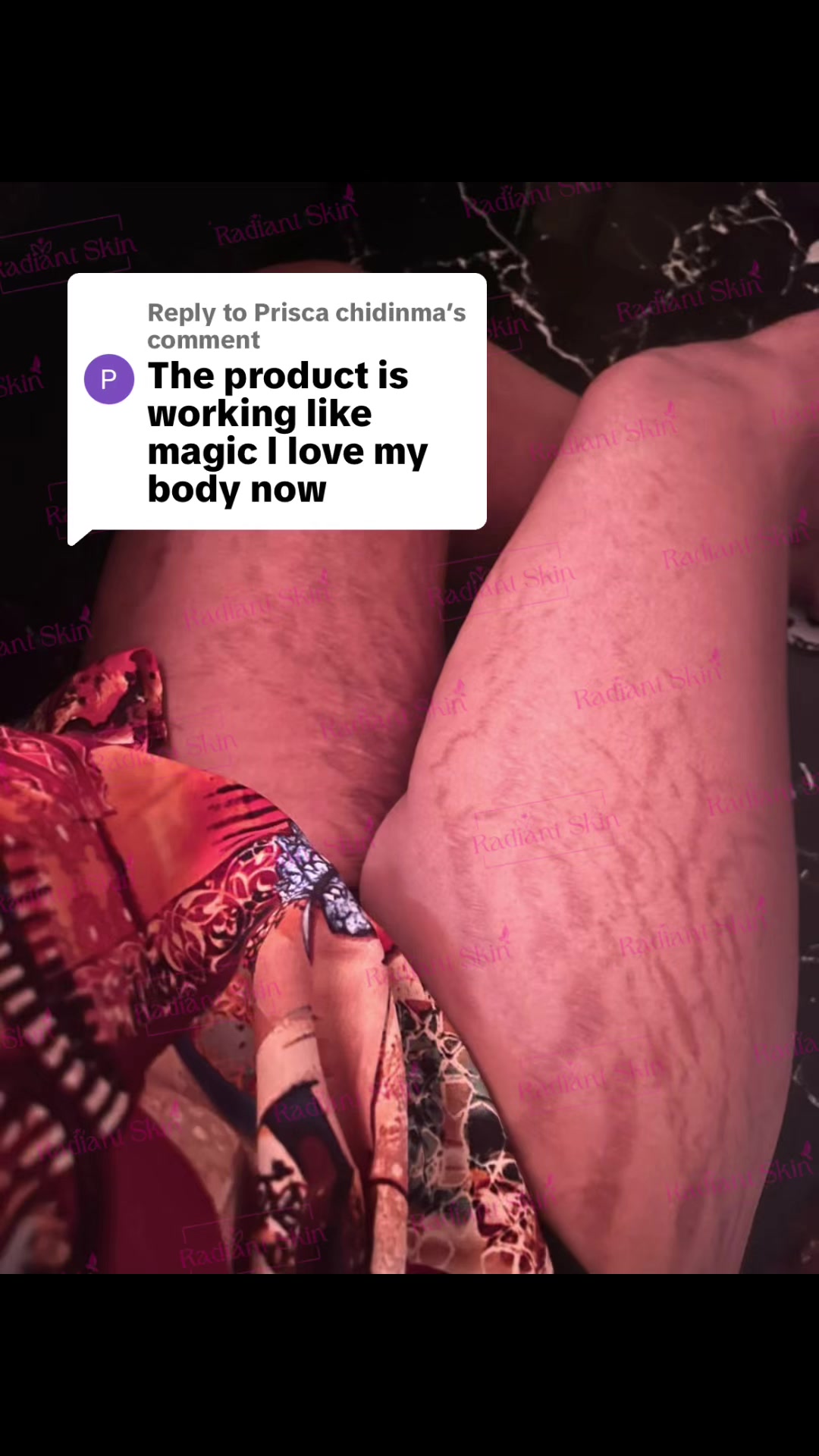 @Radiant skin